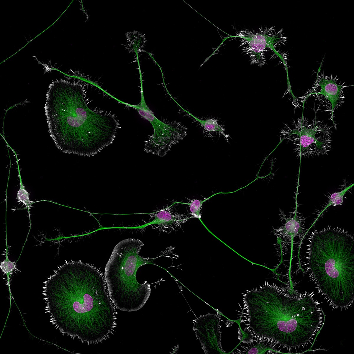 Nikon-small-photo-winner-Dr-Bruno-Cisterna-Dr-Eric-Vitriol-mouse-brain-tumor-cells